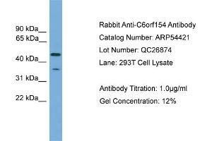 WB Suggested Anti-C6orf154  Antibody Titration: 0. (C6orf154 抗体  (N-Term))