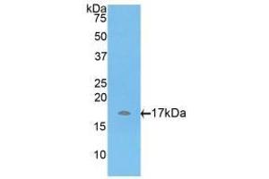 Western blot analysis of recombinant Rat ADAMTS7. (ADAMTS7 抗体  (AA 444-575))