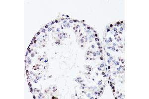 Immunohistochemistry of paraffin-embedded mouse testis using FGF12 antibody (ABIN3016419, ABIN3016420, ABIN1679841 and ABIN6219744) at dilution of 1:150 (40x lens). (FGF12 抗体  (AA 1-181))