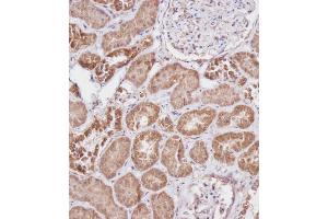 Immunohistochemical analysis of A on paraffin-embedded Human kidney tissue. (FBXL5 抗体  (N-Term))