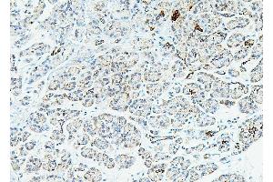IHC analysis of RPL13A using anti-RPL13A antibody (ABIN7600470). (RPL13A 抗体  (AA 2-203))