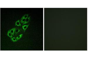 Immunofluorescence analysis of A549 cells, using MtSSB antibody. (SSBP1 抗体  (C-Term))