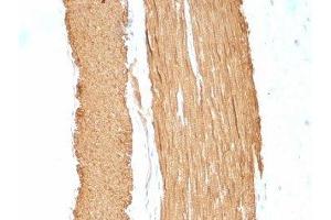 Immunohistochemistry (IHC) image for anti-Actin, alpha 2, Smooth Muscle, Aorta (ACTA2) (N-Term) antibody (ABIN3024118)