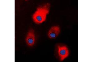 Immunofluorescent analysis of S100-A1 staining in HEK293T cells. (S100A1 抗体  (N-Term))
