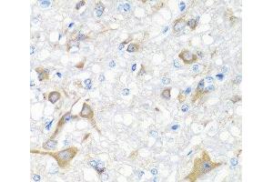 Immunohistochemistry of paraffin-embedded Rat brain using IL22 Polyclonal Antibody at dilution of 1:100 (40x lens). (IL-22 抗体)