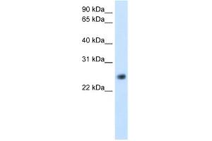 WB Suggested Anti-GGTLA4 Antibody Titration:  5. (GGTLC1 抗体  (C-Term))