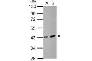 WB Image Sample (30 ug of whole cell lysate) A: HCT116 B: MCF-7 10% SDS PAGE antibody diluted at 1:500 (ZDHHC11 抗体)