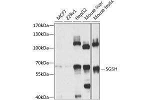 Western blot analysis of extracts of various cell lines, using SGSH antibody (ABIN6129760, ABIN6147711, ABIN6147712 and ABIN6224170) at 1:1000 dilution. (SGSH 抗体  (AA 273-502))