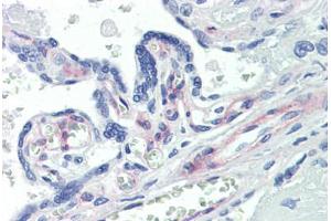 Human Placenta (formalin-fixed, paraffin-embedded) stained with PDGFRB antibody ABIN462353 followed by biotinylated anti-mouse IgG secondary antibody ABIN481714, alkaline phosphatase-streptavidin and chromogen. (PDGFRB 抗体)