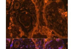 Immunofluorescence analysis of Human placenta using TEK Polyclonal Antibody at dilution of 1:100. (TEK 抗体)