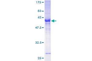 ZNF215 Protein (AA 1-304) (GST tag)
