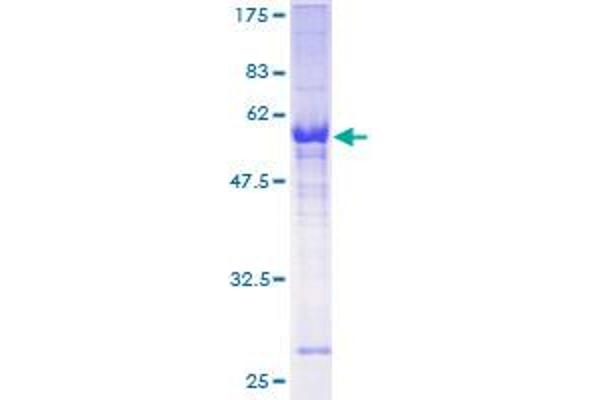 ZNF215 Protein (AA 1-304) (GST tag)