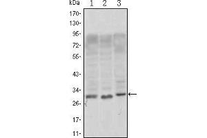 Western blot analysis using CD69 mouse mAb against, Jurkat (1), L1210 (2) and TPH-1 (3) cell lysate. (CD69 抗体)