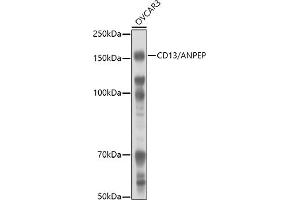 Western blot analysis of extracts of OVC cells, using CD13/ANPEP antibody (ABIN6131185, ABIN6136911, ABIN6136912 and ABIN6221309) at 1:1000 dilution. (CD13 抗体  (AA 668-967))