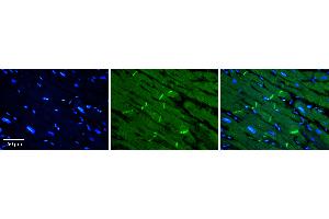 Immunohistochemistry (IHC) image for anti-Solute Carrier Family 40 (Iron-Regulated Transporter), Member 1 (SLC40A1) (Middle Region) antibody (ABIN2781643)