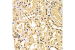 Immunohistochemistry of paraffin-embedded human kidney using SFN Antibody. (14-3-3 sigma/SFN 抗体  (AA 1-248))