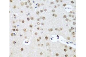 Immunohistochemistry of paraffin-embedded Mouse brain using UTP14A Polyclonal Antibody at dilution of 1:100 (40x lens). (UTP14A 抗体)