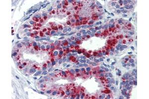 Immunohistochemistry (IHC) image for anti-Potassium Channel, Subfamily K, Member 9 (KCNK9) (N-Term) antibody (ABIN2776216) (KCNK9 抗体  (N-Term))