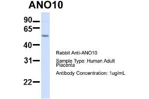 Hum. (Anoctamin 10 抗体  (C-Term))