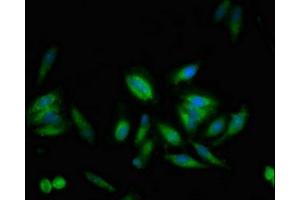 Immunofluorescent analysis of Hela cells using ABIN7174250 at dilution of 1:100 and Alexa Fluor 488-congugated AffiniPure Goat Anti-Rabbit IgG(H+L) (USP1 抗体  (AA 453-592))