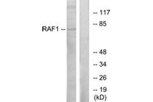 Western Blotting (WB) image for anti-V-Raf-1 Murine Leukemia Viral Oncogene Homolog 1 (RAF1) (AA 311-360) antibody (ABIN2888699) (RAF1 抗体  (AA 311-360))