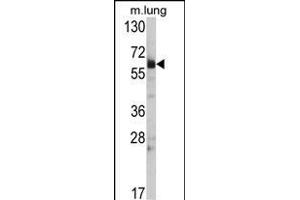 Western blot analysis of Hsp 60 Antibody (N-term) (ABIN390772 and ABIN2841030) in mouse lung tissue lysates (35 μg/lane). (HSPD1 抗体  (N-Term))