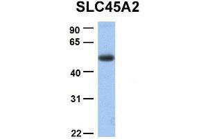 Host:  Rabbit  Target Name:  SLC45A2  Sample Type:  Human Fetal Lung  Antibody Dilution:  1. (SLC45A2 抗体  (C-Term))