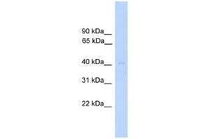 WB Suggested Anti-DUSP5 Antibody Titration: 0. (DUSP5 抗体  (Middle Region))