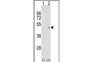 Western blot analysis of P2K2 (arrow) using rabbit polyclonal P2K2- (ABIN1881526 and ABIN2842063). (MEK2 抗体  (AA 200-229))