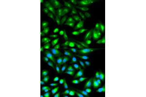 Immunofluorescence analysis of HeLa cells using RHOC antibody. (RHOC 抗体)