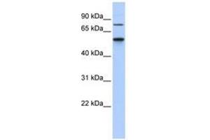Image no. 1 for anti-Casein Kinase 1, gamma 1 (CSNK1G1) (AA 301-350) antibody (ABIN6740507) (CSNK1G1 抗体  (AA 301-350))