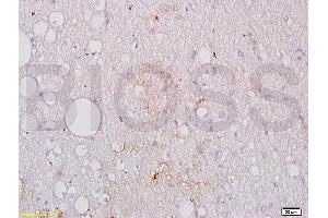 Formalin-fixed and paraffin embedded human brain tissue labeled with Anti-GPIIb Polyclonal Antibody, Unconjugated (ABIN748358) at 1:200 followed by conjugation to the secondary antibody, (SP-0023), and DAB staining (Integrin Alpha2b 抗体  (AA 351-450))