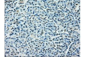 Immunohistochemical staining of paraffin-embedded pancreas tissue using anti-TYRO3mouse monoclonal antibody. (TYRO3 抗体)