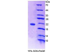 SDS-PAGE analysis of Human WTAP Protein. (WTAP 蛋白)