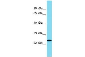 Host: Rabbit Target Name: C8orf46 Sample Type: Fetal Liver lysates Antibody Dilution: 1. (C8ORF46 抗体  (C-Term))