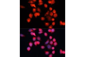 Immunofluorescence analysis of HeLa cells using SLC25 antibody (ABIN7270430) at dilution of 1:100 (40x lens). (SLC25A5 抗体  (AA 150-250))
