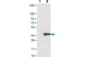 Western blot analysis of Lane 1: Negative control (vector only transfected HEK293T lysate). (ADO 抗体)