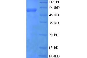 SDS-PAGE (SDS) image for Ret Oncogene (RET) (AA 24-538) protein (His tag) (ABIN5710938) (Ret Oncogene Protein (RET) (AA 24-538) (His tag))