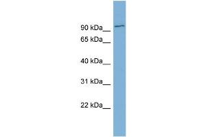 WB Suggested Anti-FBXO34  Antibody Titration: 0. (FBXO34 抗体  (Middle Region))