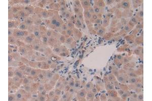 Used in DAB staining on fromalin fixed paraffin- embedded liver tissue (Olfactomedin 4 抗体  (AA 407-510))