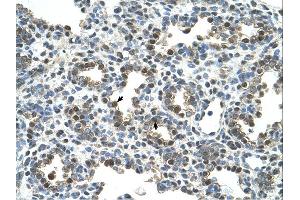Immunohistochemistry (IHC) image for anti-Osteoactivin (GPNMB) (N-Term) antibody (ABIN2781893)