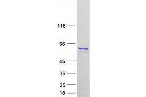 Western Blotting (WB) image for Telomeric Repeat Binding Factor (NIMA-Interacting) 1 (TERF1) (Transcript Variant 2) protein (Myc-DYKDDDDK Tag) (ABIN2733428)