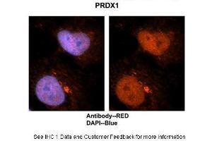 Researcher: Dr. (Peroxiredoxin 1 抗体  (N-Term))