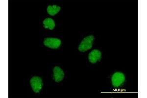 Immunofluorescence of monoclonal antibody to ATR on HeLa cell. (ATR 抗体  (AA 2545-2644))