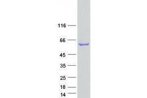 Western Blotting (WB) image for Flavin Containing Monooxygenase 3 (FMO3) (Transcript Variant 1) protein (Myc-DYKDDDDK Tag) (ABIN2721249)