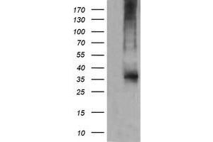 Western Blotting (WB) image for anti-T-cell surface glycoprotein CD1c (CD1C) antibody (ABIN2670659) (CD1c 抗体)