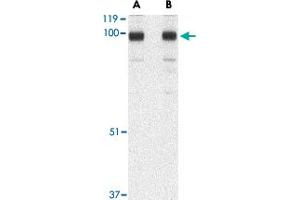 Western blot analysis of STIM2 in A-20 cell lysate with STIM2 polyclonal antibody  at (A) 0. (Stim2 抗体  (C-Term))