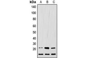 Western blot analysis of LIF expression in HEK293T (A), Raw264. (LIF 抗体  (C-Term))