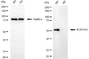 anti-Aldehyde Dehydrogenase 1 Family, Member A3 (ALDH1A3) antibody