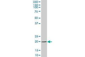 SAT2 MaxPab polyclonal antibody. (SAT2 抗体  (AA 1-170))